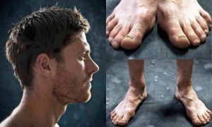 Así de horrorosos son los pies de algunos futbolistas (Fotos + OMG)