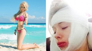 La “Barbie Humana” recibió una brutal golpiza y quedó desfigurada (Fotos)