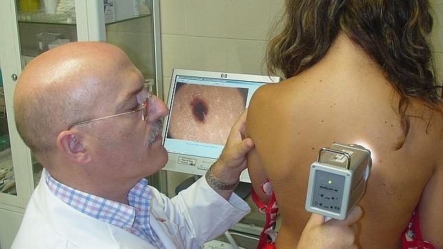 Descubren cómo el melanoma consigue “engañar” al sistema inmunológico