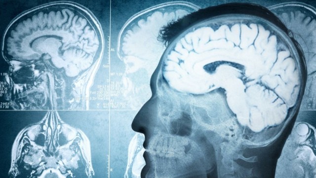 Encuentran actividad cerebral en un paciente 10 minutos después de su muerte clínica