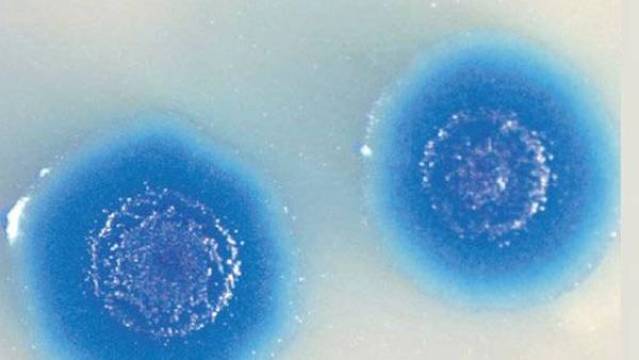 Mycoplasma mycoides. Es la primera célula bacteriana artificial