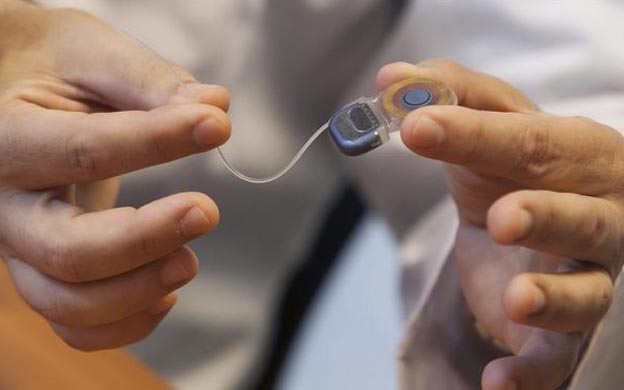 Científicos rusos inventan revestimiento de implantes antibacteriano