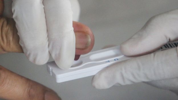 Italia utilizará test serológicos para detectar anticuerpos contra el coronavirus