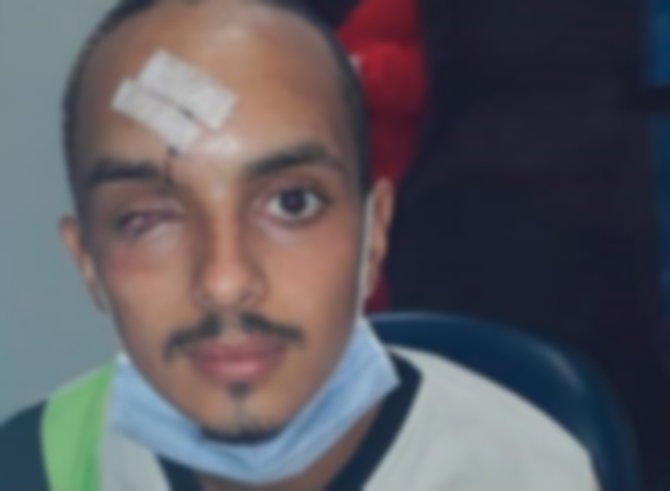 El drama del venezolano que perdió su ojo tras recibir golpes y machetazos en su viaje de vuelta