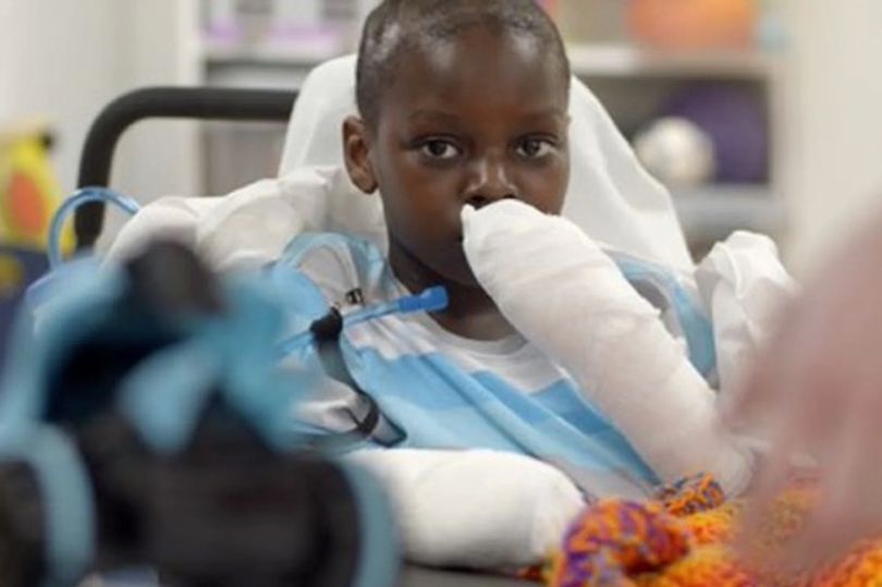 La desgarradora historia de un niño en EEUU que perdió manos y piernas luego de contraer Covid-19