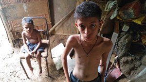 Las plagas del chavismo dejan secuelas irreversibles en niños larenses