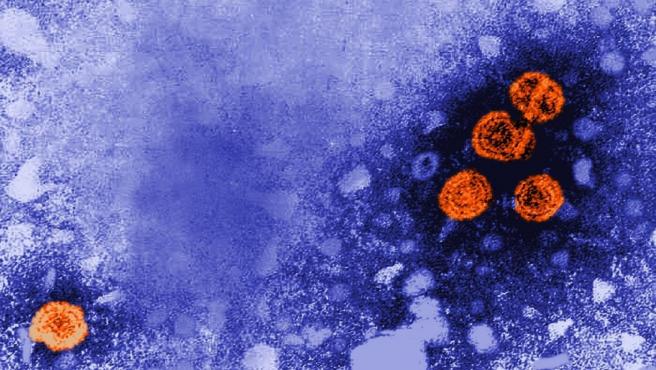 Estadísticas preocupantes: casi 100 millones de personas padecen hepatitis B o C en África, según la OMS