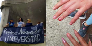 Colectivos chavistas les arrancaron las uñas de las manos a estudiantes de la ULA (video)
