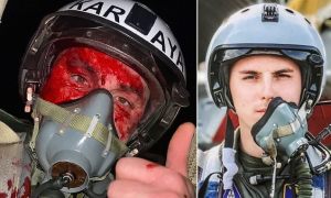 Piloto ucraniano se tomó una SELFIE de su cara ensangrentada tras derribar drones suicidas rusos