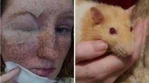 Le quemó la cara a su cuñada luego de escucharla hablando sobre la salud de la rata que tenía como mascota