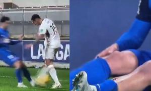 Imágenes sensibles: escalofriante falta en España le abrió la tibia a un futbolista en pleno partido