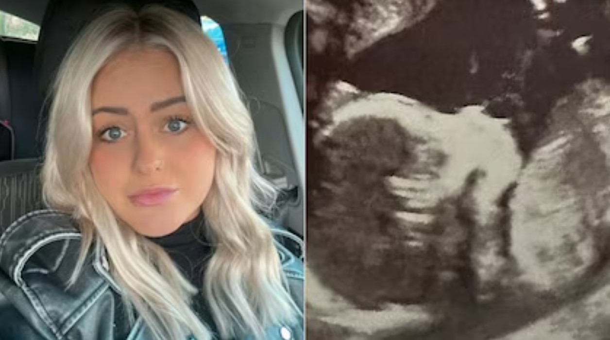 El increíble caso de Shannon Webster, la mujer con dos úteros que llevó un bebé en cada uno